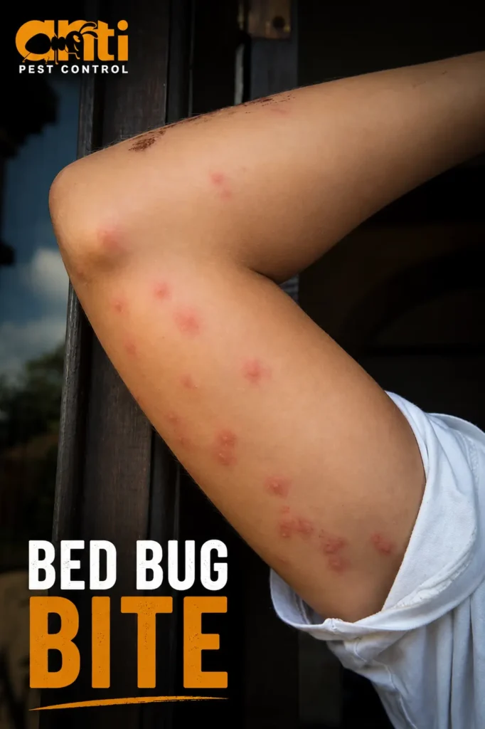 bed bug treatment dubai