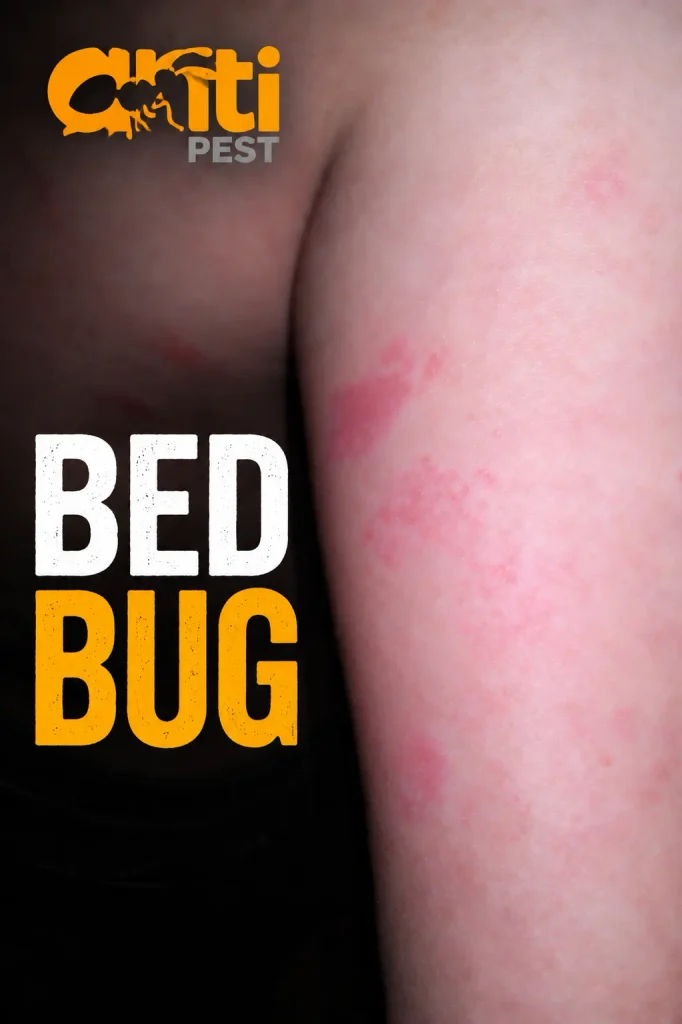 health issues caused by bed bugs
